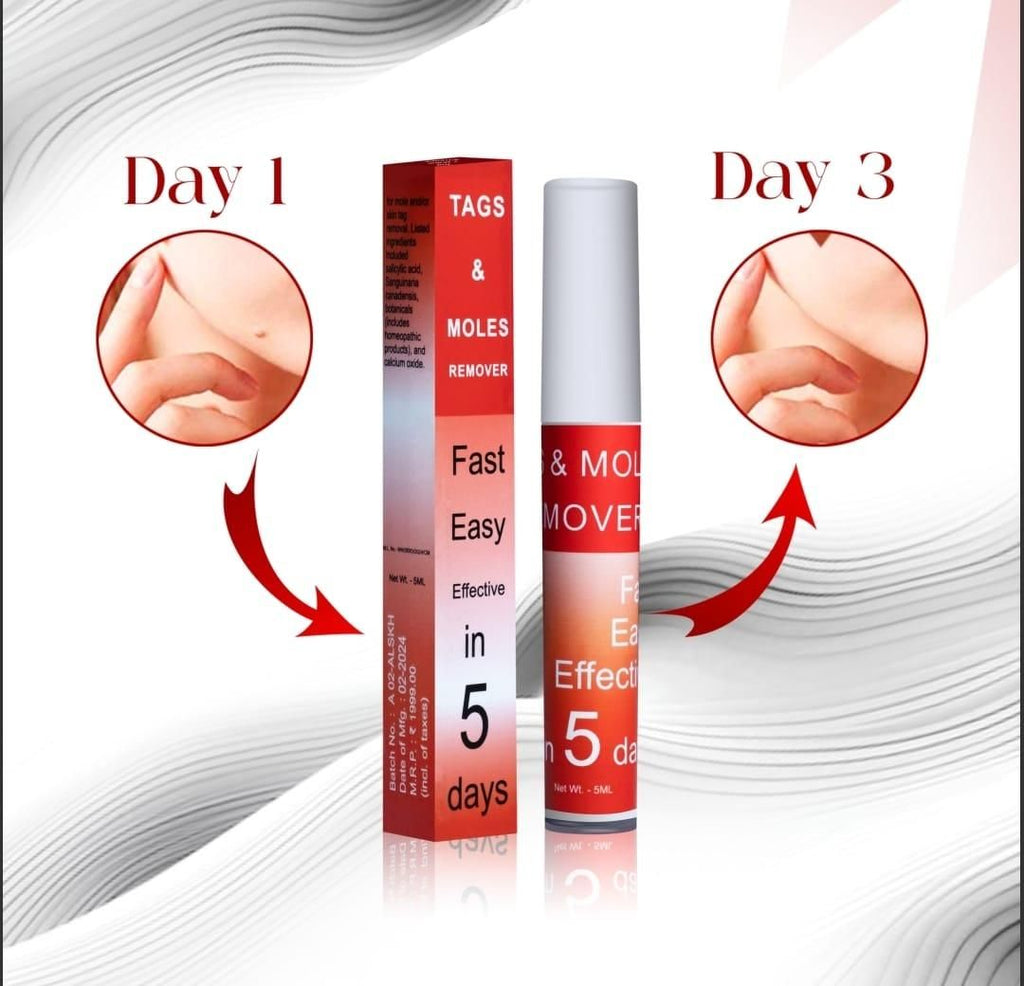 Tags & Moles Remover Pen